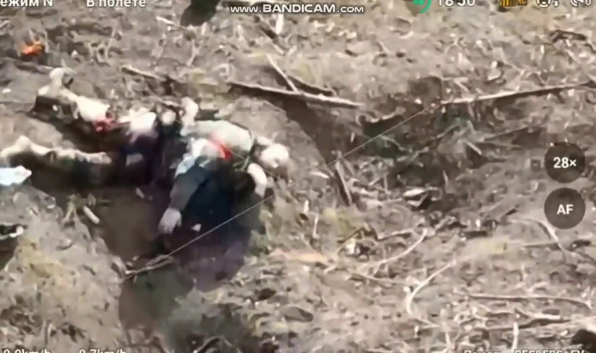 Wounded Russian soldier with horribly wounded leg shoots himself in the head